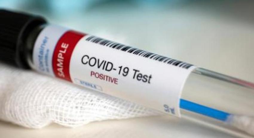12 случая на COVID-19 в област Търговище