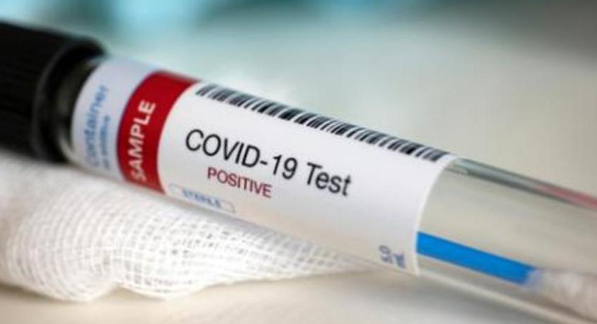 23 новозаразени и два смъртни случая с COVID-19 в област Търговище 