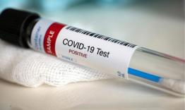 23 новозаразени и два смъртни случая с COVID-19 в област Търговище 