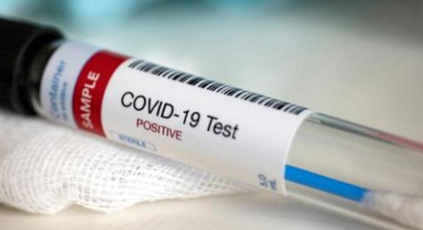 3 случая на COVID-19 в област Търговище