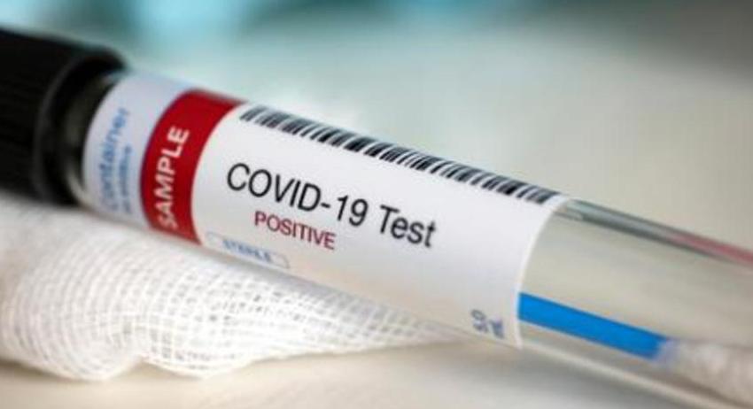  Без новозаразени с COVID-19 в област Търговище