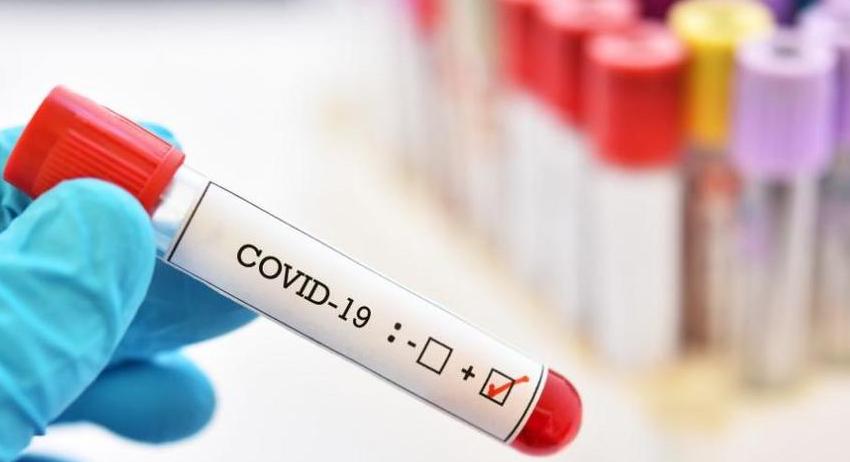 Нови 7 случая на COVID-19 в област Търговище