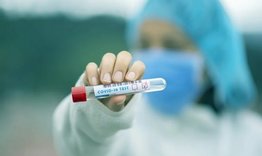 6 случая на COVID-19 в област Търговище