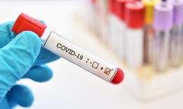 Нови 7 случая на COVID-19 в област Търговище