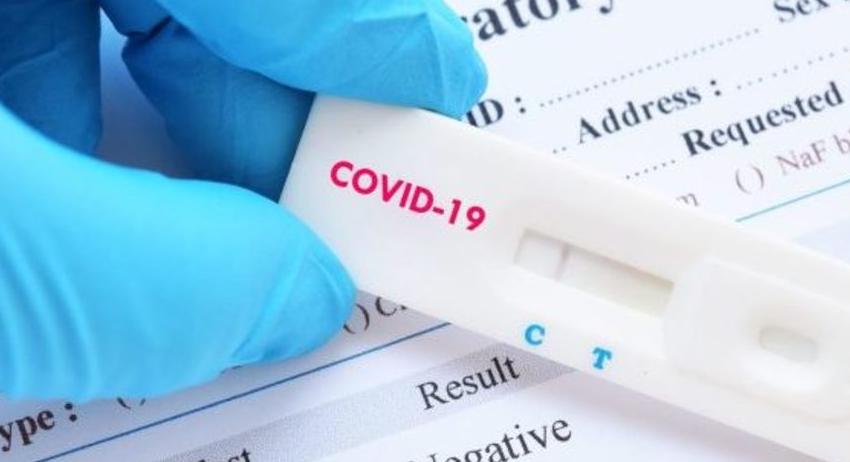 28 случая на COVID-19 са установени в област Търговище