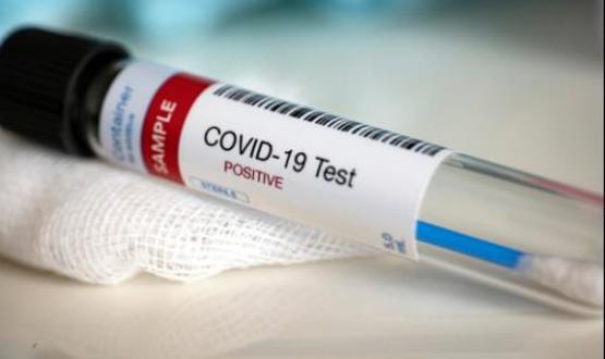 19 случая на COVID-19 в област Търговище