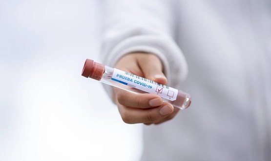 29 случая на COVID-19 в област Търговище