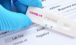 28 случая на COVID-19 са установени в област Търговище